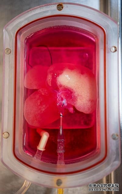 杏耀开帐号实验室培育的微型人类肝脏成功地移植到大鼠身上