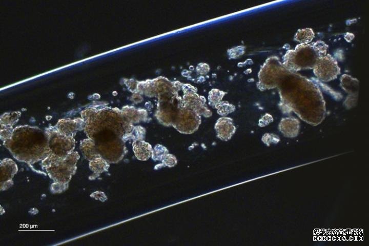 杏耀代理开号糖尿病小鼠通过可回收的毫米厚的充满细胞的水凝胶纤维得到改善
