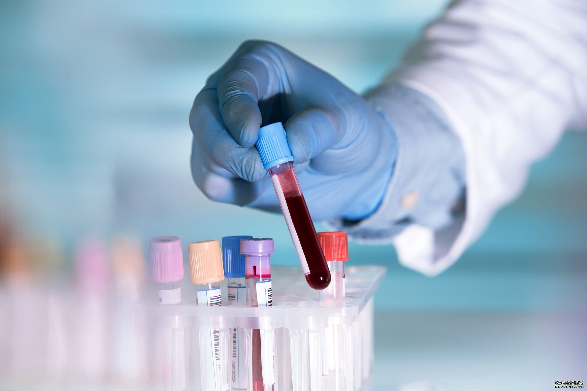 非侵入性血液检测可以比杏耀注册常规诊断方法早4年发现癌症