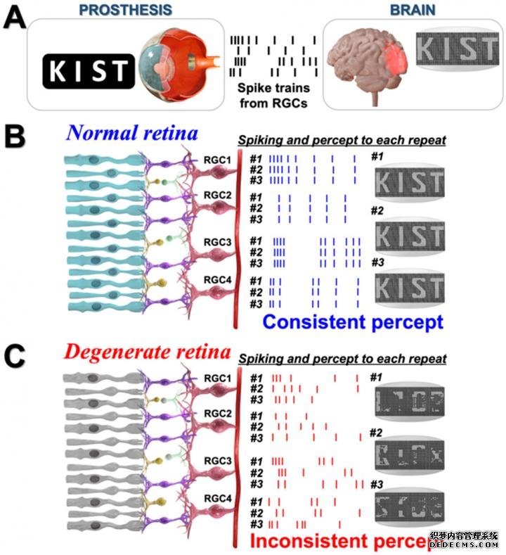杏耀代理KIST发现改善色素性视网膜炎患者人工视力的线索
