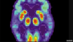 <b>杏耀流水潜在的阿尔茨海默病的新疗法是揭示通</b>