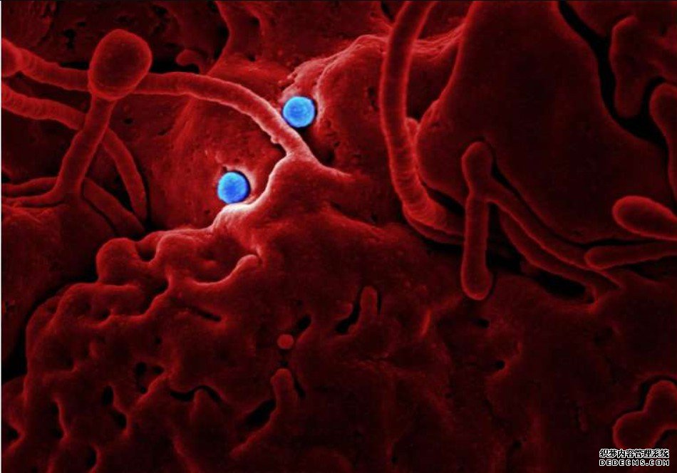 杏耀流水具有里程碑意义的人类研究首次揭示了肠道微生物、饮食和健康之间的紧密联系