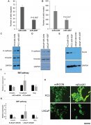 <b>致癌靶杏耀网站点:MicroRNA-4287在前列腺癌中控制上</b>