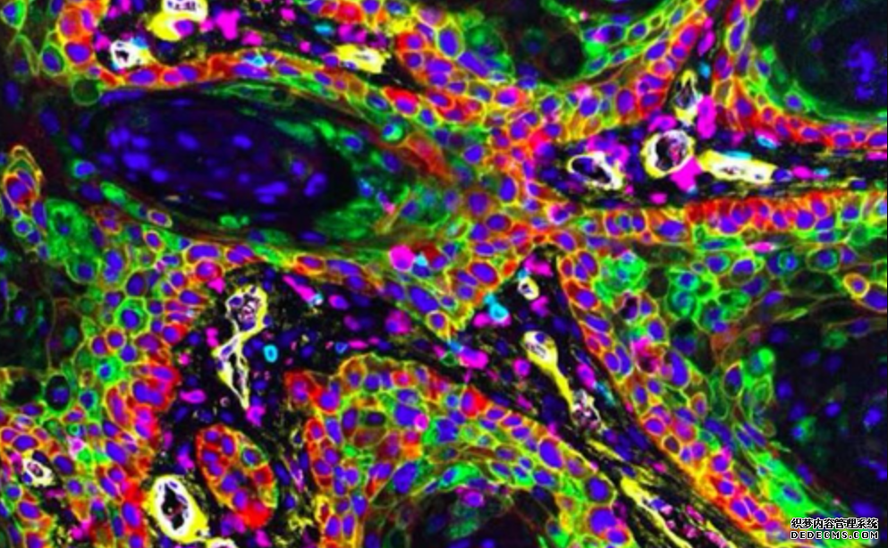 我国学者新技术突杏耀代理破拍出肝癌细胞“超清写真”