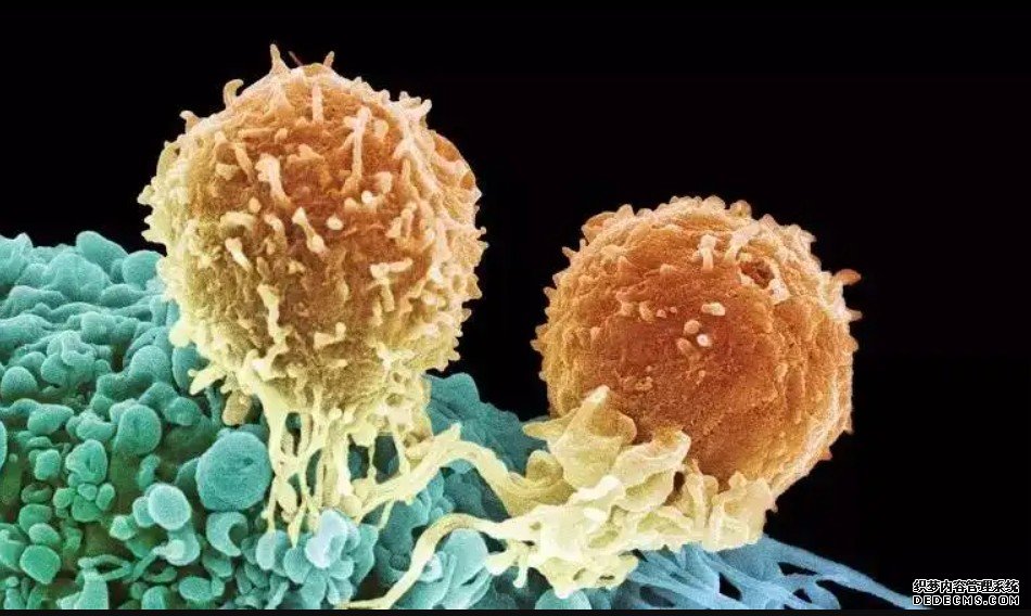 杏耀防止癌细胞转移，“杀手”T细胞有双重优势