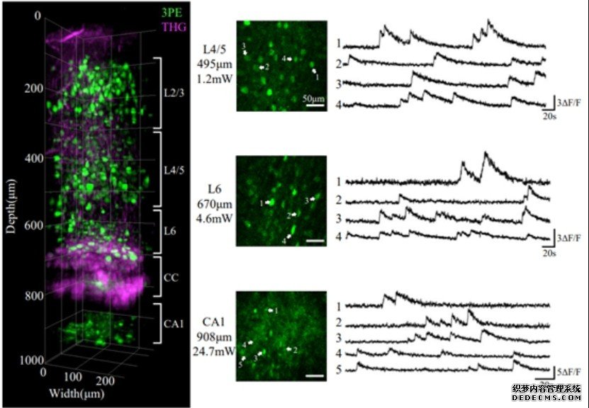 我国科学家研制“微型化三光子显微镜杏耀代理”首次实现小鼠“深脑成像”