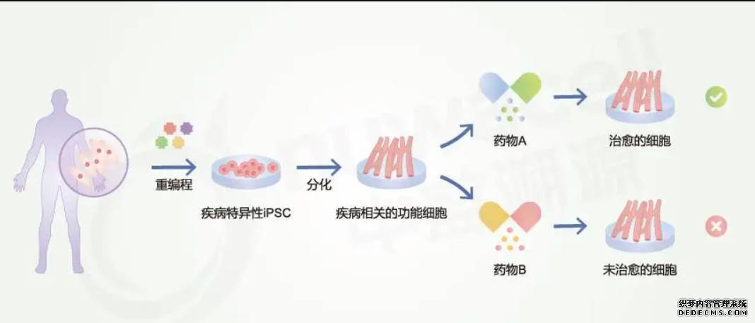 一种帕金森药可安全减缓ALS症状进展沐鸣在线登录