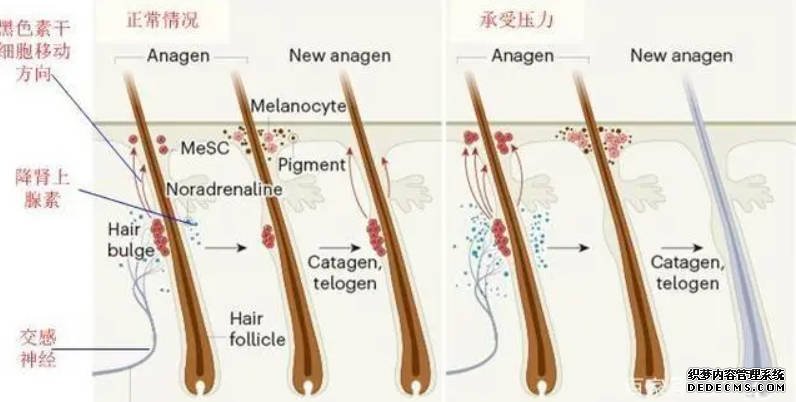 沐鸣登录软化毛囊干细胞能促毛发生长