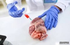 <b>沐鸣注册登录首位转基因猪心移植患者心衰原因</b>